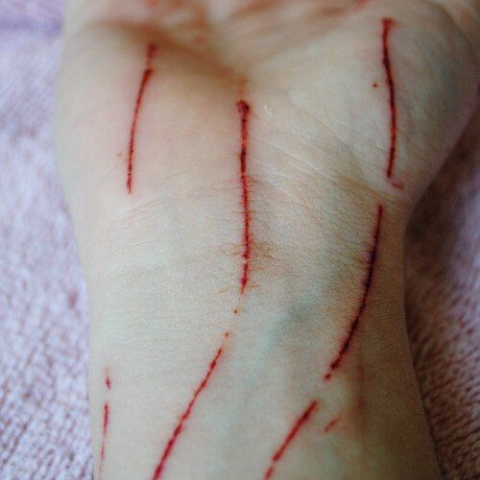 A Slash Here, A Slash There