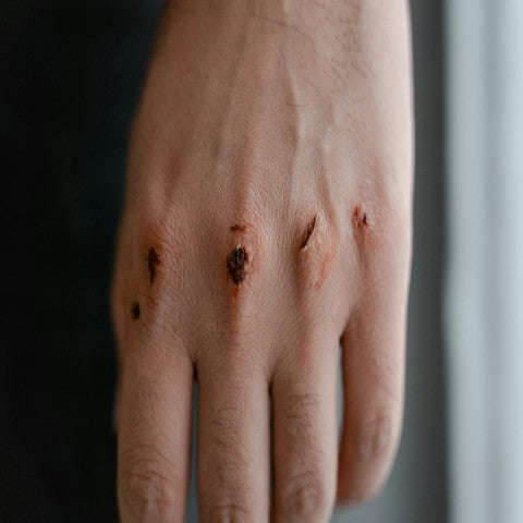 Scab